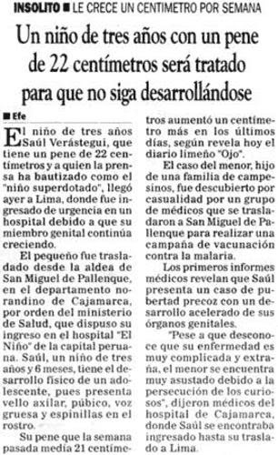 Si es posible aumentar el miembro viril en el espesor